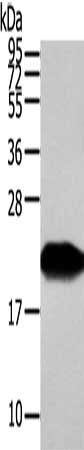 VPS25 Antibody