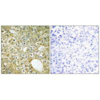 ACVRL1 Antibody