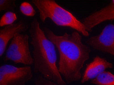 Phospho-TH (Ser19) Antibody