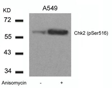Phospho-CHEK2 (Ser516) Antibody