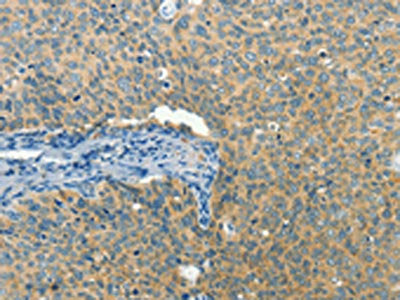 BCAT1 Antibody