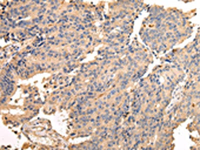 SDCBP Antibody