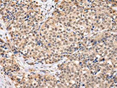 TBL1X Antibody