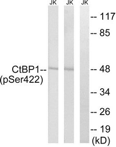 Phospho-CTBP1 (Ser422) Antibody