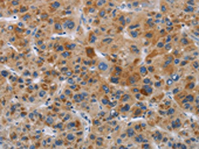 IAPP Antibody