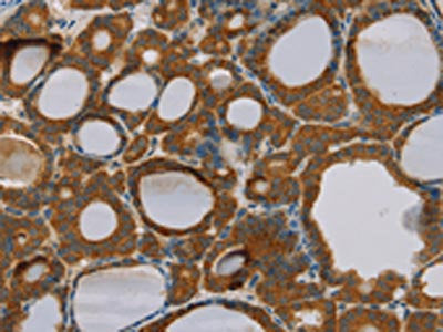 PARL Antibody