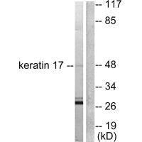 KRT17 Antibody
