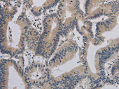 ACVR1B Antibody