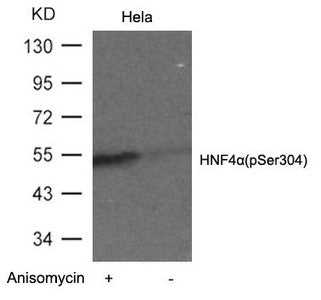 Phospho-HNF4A (Ser304) Antibody
