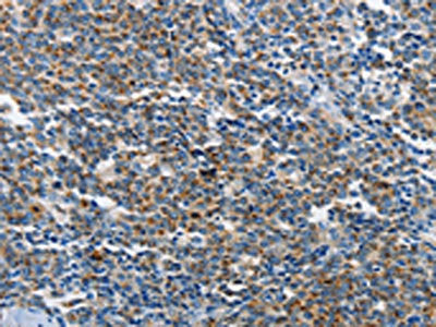 NEK1 Antibody