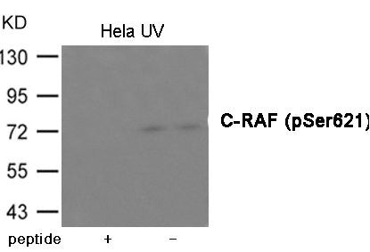 Phospho-RAF1 (Ser621) Antibody