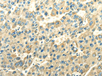 DLAT Antibody