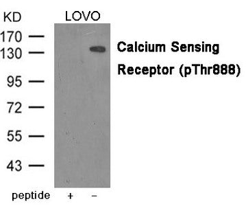 Phospho-CASR (Thr888) Antibody