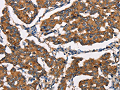 DICER1 Antibody