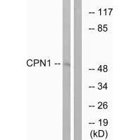 CPN1 Antibody