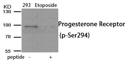 Phospho-PGR (Ser294) Antibody