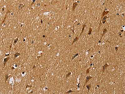 NDUFS5 Antibody