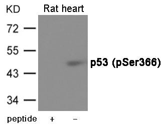 Phospho-TP53 (Ser366) Antibody