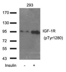 Phospho-IGF1R (Tyr1280) Antibody