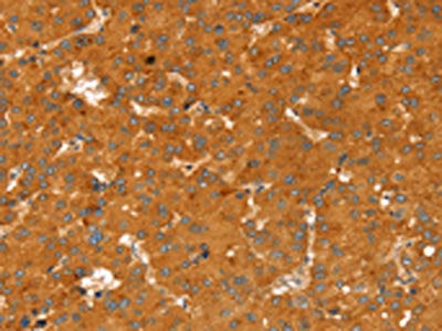 RGS4 Antibody