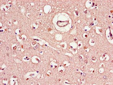 C1QTNF9B Antibody