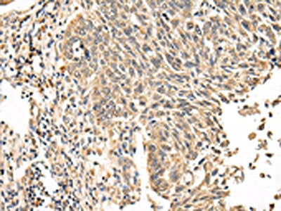VPS53 Antibody