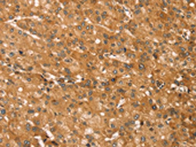 SNAP29 Antibody