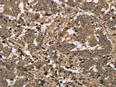 IKBIP Antibody