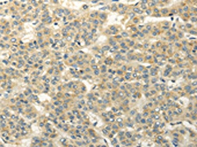 RASD2 Antibody