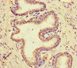MCIDAS Antibody