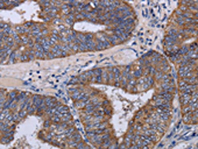 MT3 Antibody
