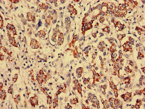 RTCA Antibody