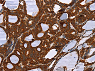 PPP2R3C Antibody