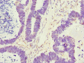ZWINT Antibody