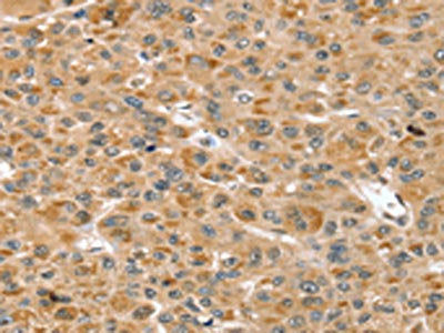 RNH1 Antibody
