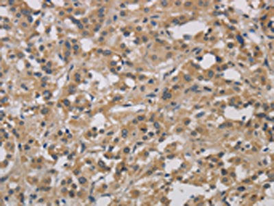 DCN Antibody