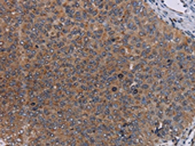 LIPE Antibody