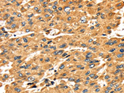 SH3KBP1 Antibody