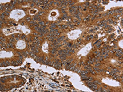 HSD17B4 Antibody