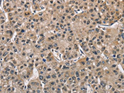 PGK1 Antibody