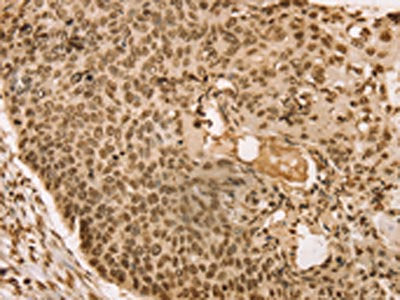 SNX8 Antibody