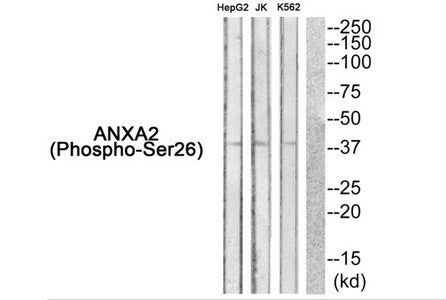 Phospho-ANXA2 (Ser26) Antibody