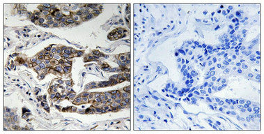 Phospho-CCDC88A (Ser1417) Antibody