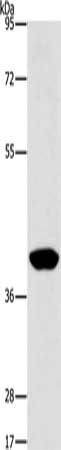 PHYKPL Antibody