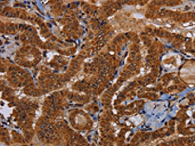 WDR83 Antibody