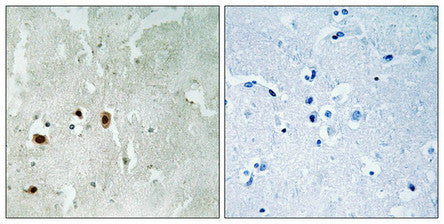 Phospho-KAT5 (Ser90) Antibody