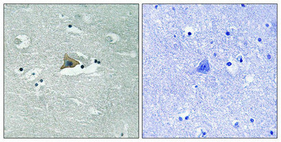 Phospho-CLDN5 (Tyr217) Antibody