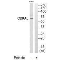 CDKAL1 Antibody