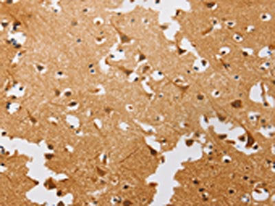 ATG4C Antibody