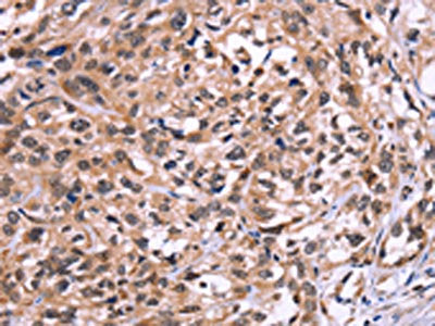 AMIGO2 Antibody